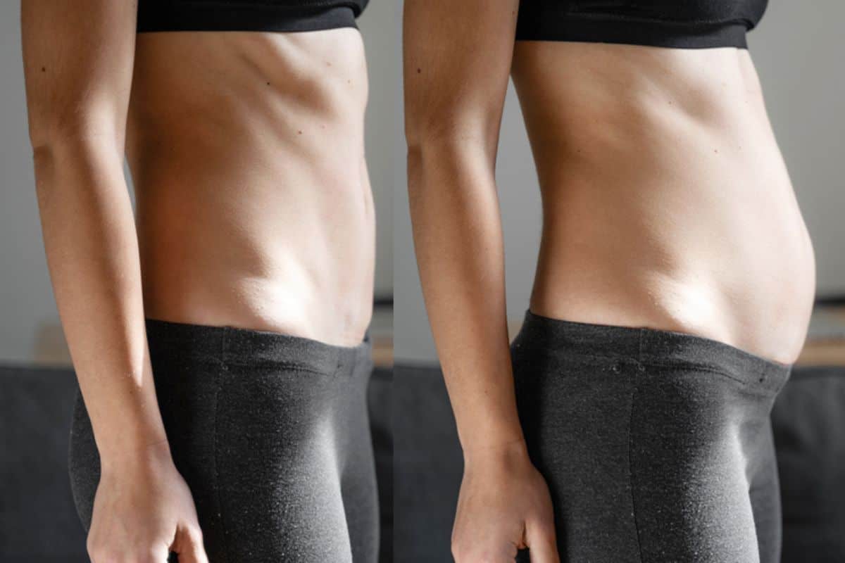 How long does diastasis recti take to improve Tyne & Wear?