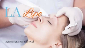 Woman receiving Actinic Keratosis Removal Treatment Tyne & Wear