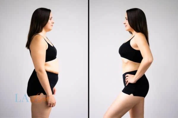 LA-EMS Body Sculpting Tyne & Wear results before and after of womans results on body toning.