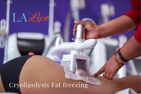women getting fat freezing Tyne & Wear