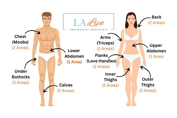 LA LIPO Cryolipolysis Areas Tyne & Wear