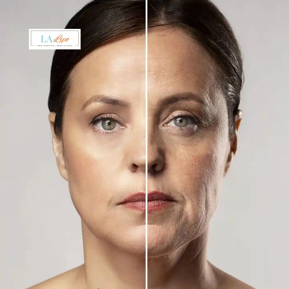 How Can You Tell If Non-Surgical Skin Tightening Is Right for You Tyne & Wear?