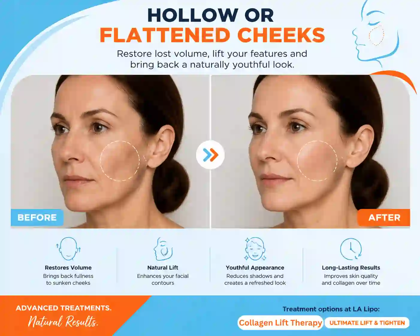 Sign #4: Hollow or Flattened Cheeks Tyne & Wear