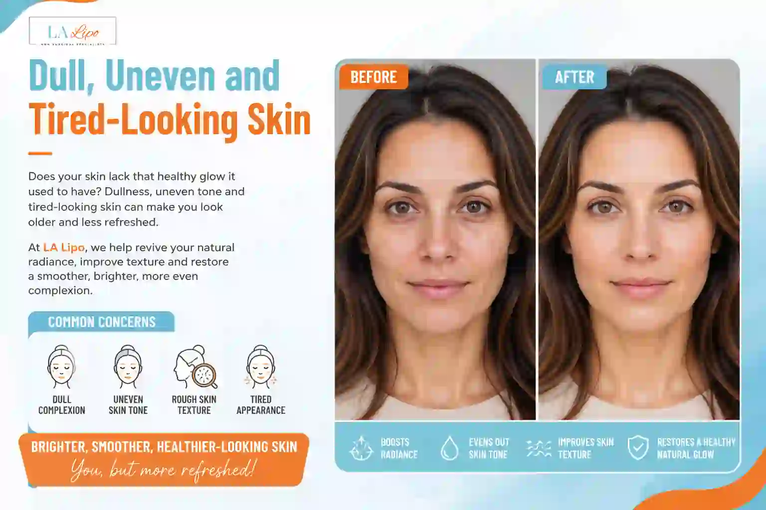 Sign #5: Dull, Uneven and Tired-Looking Skin Tyne & Wear
