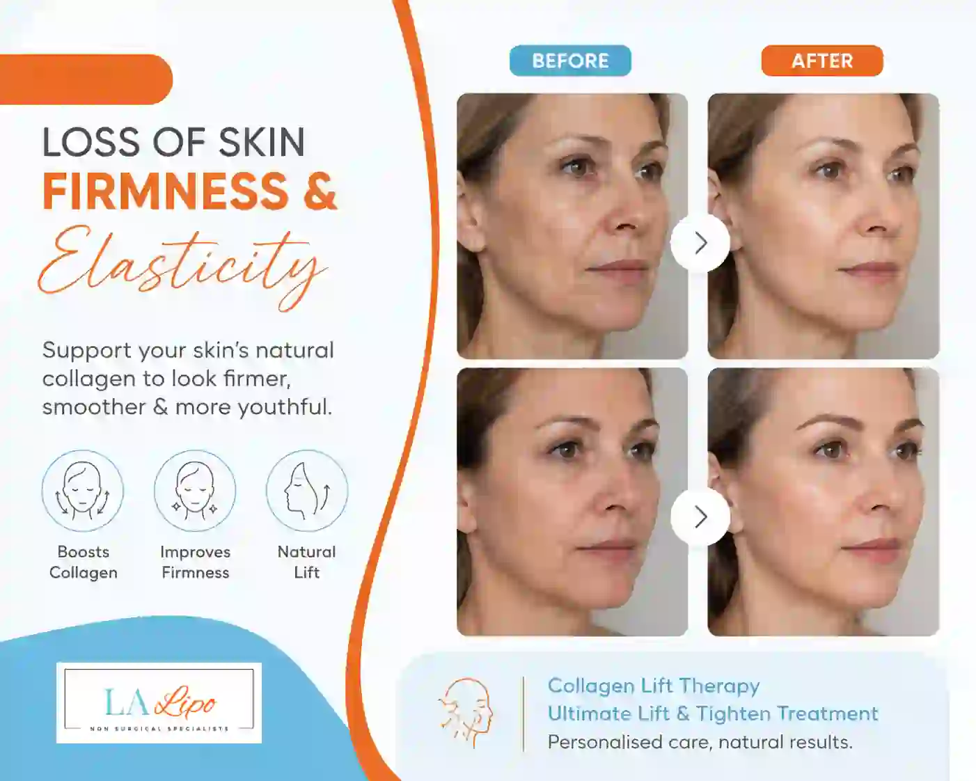 Sign #7: Loss of Skin Firmness and Elasticity Tyne & Wear