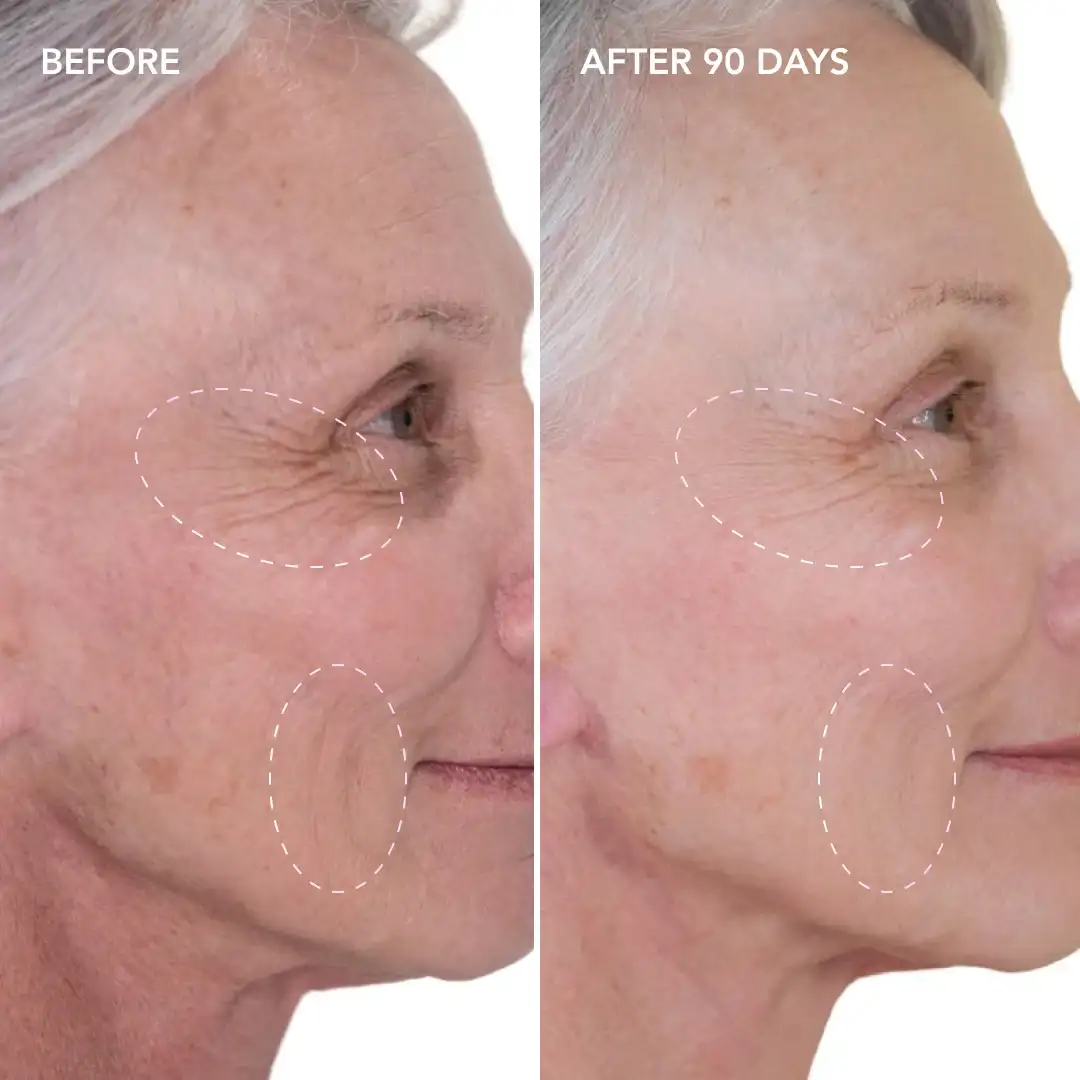 When will you see results Tyne & Wear